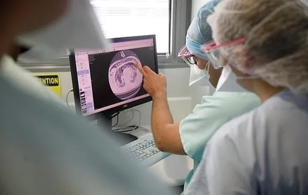 Son dakika: Koronavirüs akciğerlere işte böyle yayılıyor-5