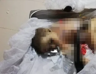 9 aylık bebek ve 11 yaşındaki Elif YPG/PKK’nın kurbanı oldu