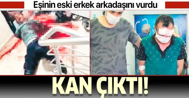 Esinin Eski Erkek Arkadasini Vurdu Takvim