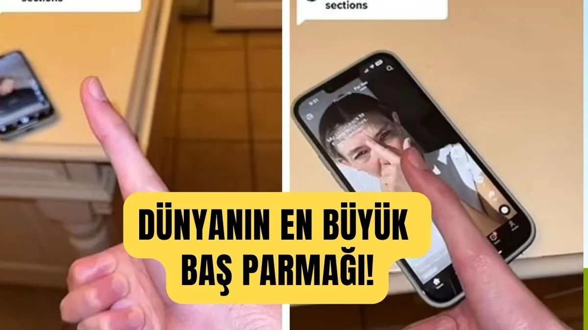 Tiktok fenomeni dünyanın en büyük başparmağına sahip! Bu yüzden telefon bile kullanamıyor