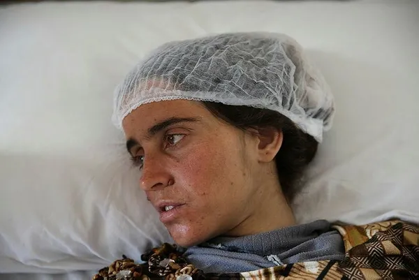 YPG'nin saldırısında yaralanan çocuklar Türkiye'de-3