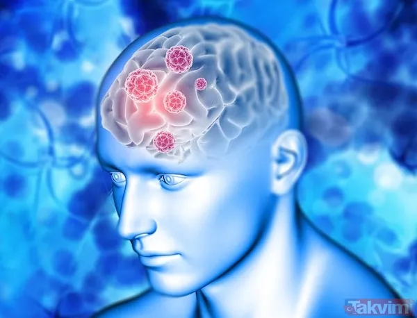 30 saniyelik el testiyle gizli beyin tümörü riski ortaya çıkabilir - 6