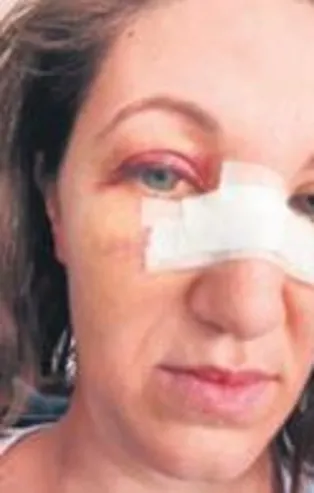 Adana'da gelinlik yumruğu!