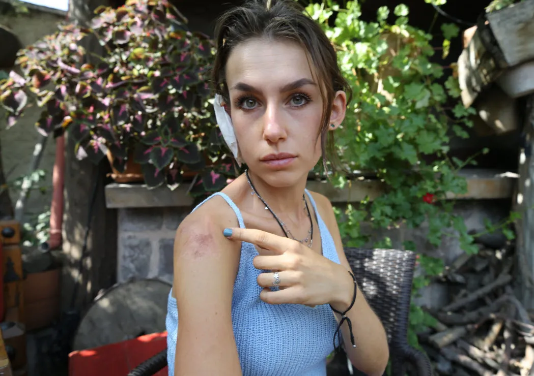 Başıboş köpek sorunu turizmi tehdit ediyor! Kapadokya'da 2 İtalyan turist yaralandı: Korku dolu anlar - 4