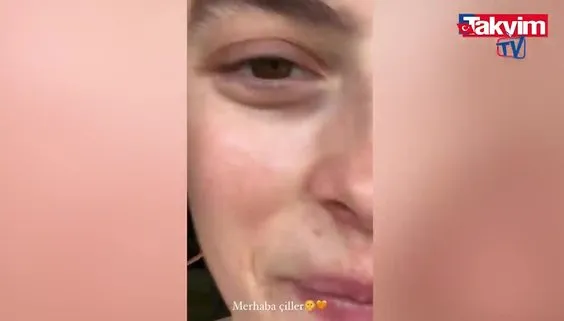 Melis Sezen ‘’merhaba çiller’’ deyip en doğal halini paylaştı! Sosyal medya onu konuştu