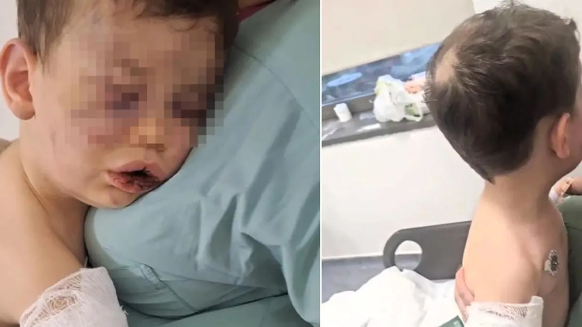 2 yaşındaki bebek öldüresiye dövüldü!