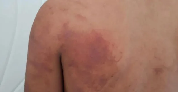 Şanlıurfa'da dehşet! 15 yaşındaki çocuğa babası ve amcasından zincirli işkence: Sebebi şoke etti...