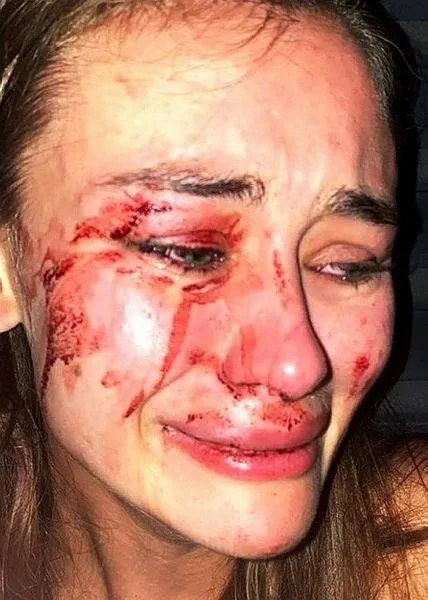 SON DAKİKA: Çeşme'de darp edilen Ukraynalı top model Daria Kyryliuk'tan flaş karar!-2
