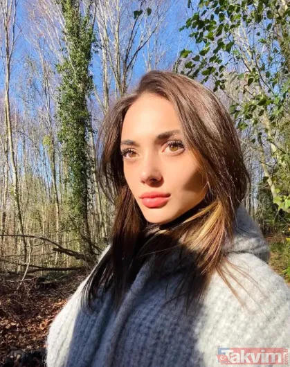 Benim Adım Melek'in Defne'si Rabia Soytürk'ün estetiksiz hali piyasaya çıkınca...25 yaşındaki Rabia estetikli çıktı herkes şaştı - 2