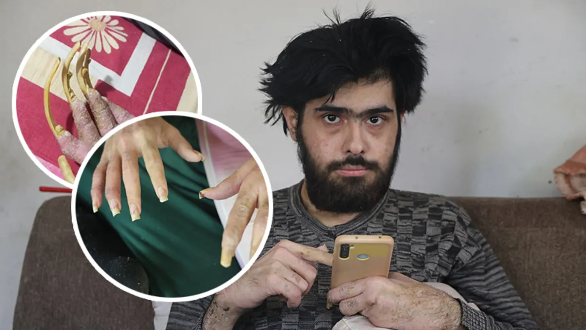 Her şey depremden sonra başladı! Ne dışarı çıkıyor ne yıkanıyor! Telefon bağımlısı Barış Özbay şaşkına çevirdi