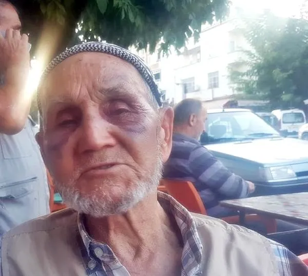 Böyle canilik görülmedi! 86 yaşındaki öz babasını tanınmaz hale getirdi!-1