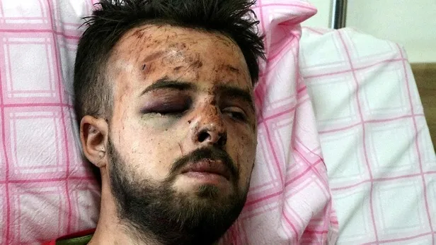 SON DAKİKA: Trabzon'daki feci kazadan kurtulan baba-oğul o anları anlattı: Bir anda yoldan çıktık-5