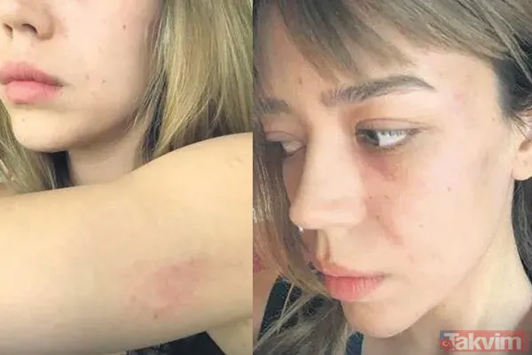 Özcan Deniz eski eşine şiddet uyguladı mı? Feyza Aktan yalanladı ancak detaylar kafa karıştırdı! - 7