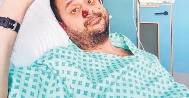 Avrupa’daki ilk Maymun Çiçeği hastası Harun Tulunay DSÖ’nün Farkındalık yüzü oldu