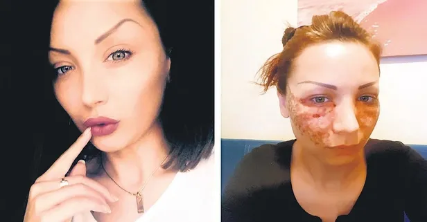 'Örümcek ağı' hayatını kabusa çevirdi: Tatyana Toleva 2 kuaför hakkında dava açıldı
