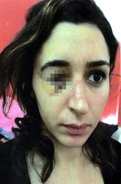 Tuğçe Aras A.'yı av tüfeğiyle vuran cani için istenen ceza belli oldu-2