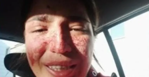 Eski eşinin saldırısına uğrayan kadın sosyal medyadan yardım çığlığı attı