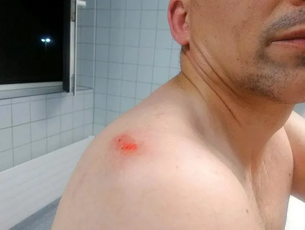 Son dakika haberi: Almanya'da ırkçı saldırı: Türk taksiciyi darp ettiler!-1