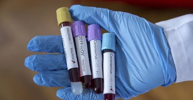 Yeni vaka 918’e düştü