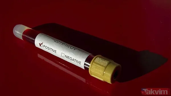 Araştırma sonuçlandı! İşte koronavirüste ölüm oranını azaltan vitamin... - 4