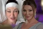Bir dönem 'Yerli Angelina Jolie' olarak anıldı! Umut Akyürek tüm estetiklerini tek tek açıkladı: Alın daraltma, burun...