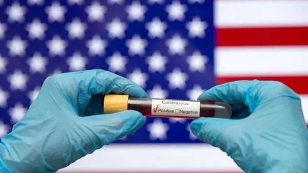 Korkutan koronavirüs araştırması! "Vakalar 13 kat fazla olabilir"-5