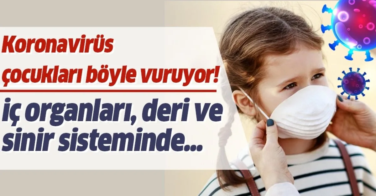 Cocuklarda Corona Viruse Bagli Hastalik Ic Organlari Deri Ve Sinir Sisteminde Takvim
