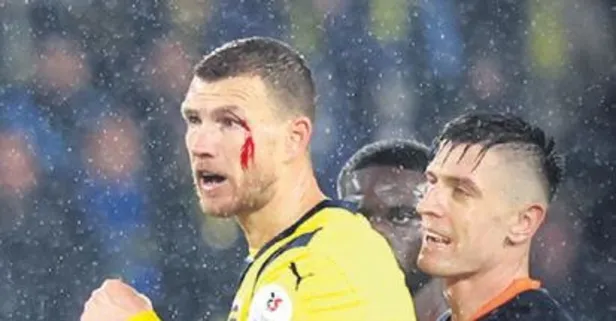 Dzeko, Ba’nın kafa darbesinin ardından kanlar içinde kaldı