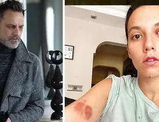 Şiddetin faili Ozan Güven olunca ortada yoklar!