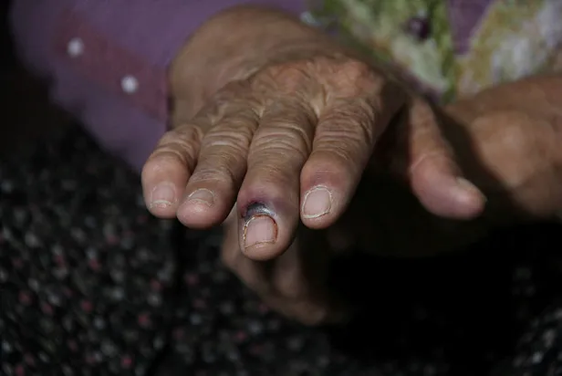 Adana'da iğrenç olay! 80 yaşındaki kadına tecavüz girişimi-4