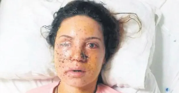 Yer: Gaziantep... Eşi pompalıyla ateş etti, bir gözünü kaybetti