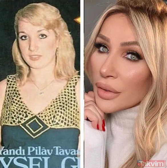 Seda Sayan'dan botoks itirafı: Botokslar, dolgular gitti bacım! Bu halleri olay yarattı - 25