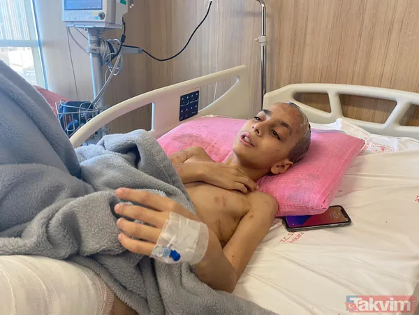 Ankara'da sokak köpeklerinin saldırısının ardından 9 ameliyat geçiren Enes Koca, yeniden yürümeye hazırlanıyor - 6