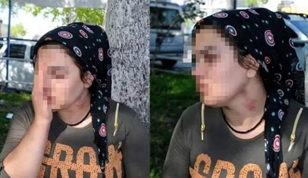 Ağabeyi hapisteyken yengesine saldırdı-3