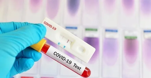 PCR testi nedir? PCR testi nasıl, nerede yapılır?