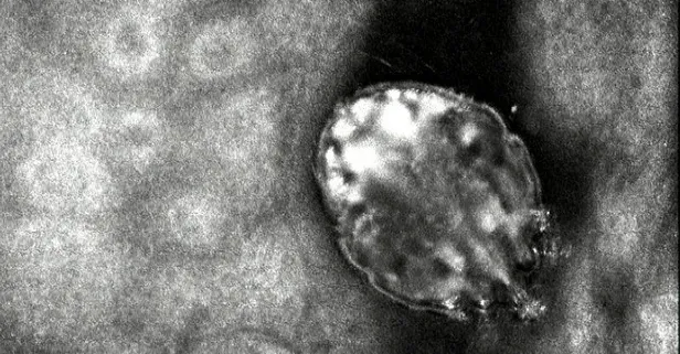 Son dakika: Koronavirüs sonrası yeni salgın! Bulaşması için 15 dakika yeterli!