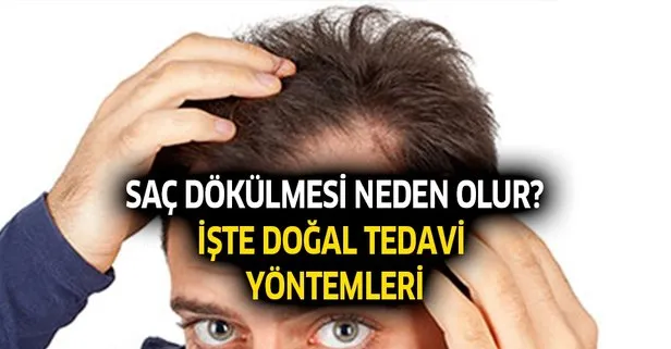 sac dokulmesine ne iyi gelir sac dokulmesi nasil gecer evde dogal tedavi yontemler takvim