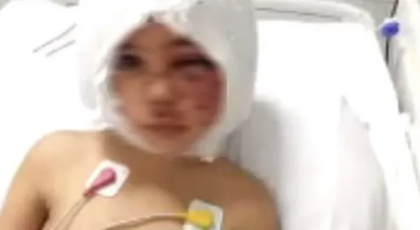 gaziantepte-iki-pitbullun-yuzunu-parcaladigi-minik-asiye-antalyaya-sevk-edildi-1640385164597.jpg Gaziantep'te iki "pitbull"un yüzünü parçaladığı minik Asiye Antalya'ya sevk edildi-2