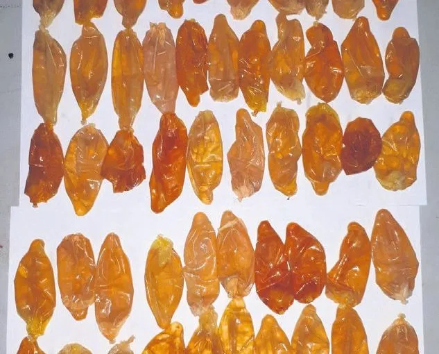 Uyuşturucu kuryesinin midesinden 54 paket kokain çıktı