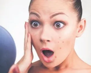 İnatçı sivilce kist habercisi