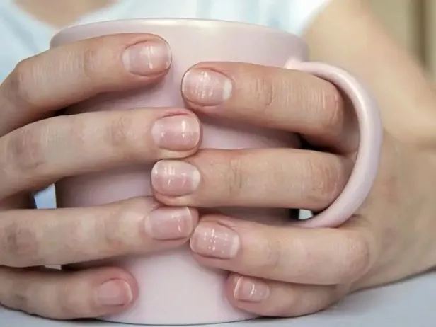 tirnaklardaki-beyaz-cizgilerin-nedeni-meger-buymus-herkes-farkli-biliyordu-meger-1697460199226.jpeg Tırnaklardaki beyaz çizgilerin nedeni meğer buymuş! Herkes farklı biliyordu: Duyunca çok şaşıracaksınız!-3