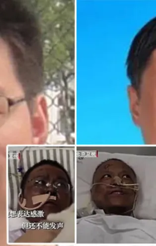 Dünyayı şoke eden olay! Koronavirüsü yendi ten rengi değişti!