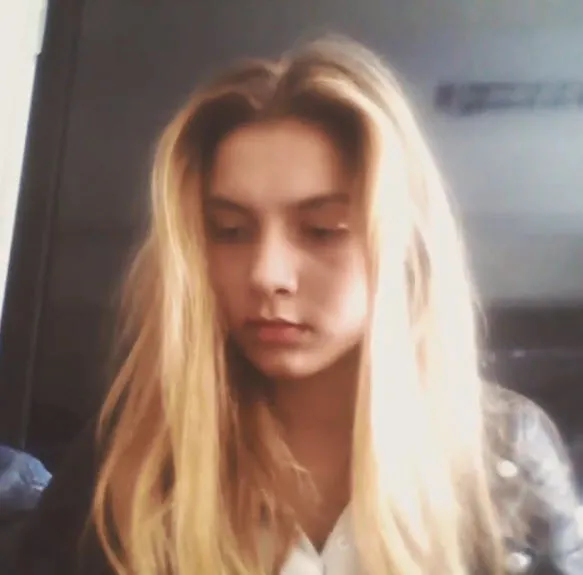 Aleyna Tilki yüzüne ne yaptırdı?-10