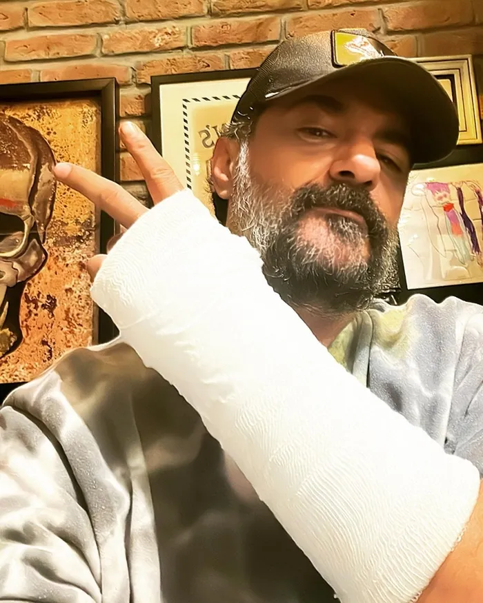 kardeslerimin-akifi-celil-nalcakan-set-kazasi-gecirdi-pinar-altug-ve-ufuk-ozkandan-yorum-gecikmedi-iste-son-ha-1702720770297.jpg Kardeşlerim'in Akif'i Celil Nalçakan set kazası geçirdi! Pınar Altuğ ve Ufuk Özkan’dan yorum gecikmedi! İşte son hali...-7