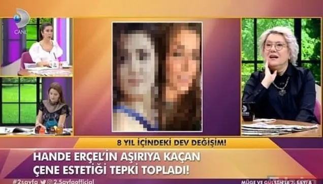 hande ercel de estetik harikasi cikti gorenler inanamadi iki fotograf arasinda sadece 8 yil var videosunu izle takvim tv
