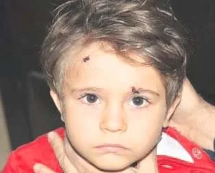 Elif’i bir köpek hastanelik etti