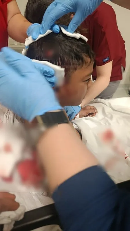 ankarada-basibos-kopek-faciasi-8-yasindaki-davut-elhamut-hastanelik-oldu-1767276626718.jpeg Ankara'da köpek saldırısına uğrayan 8 yaşındaki Davut hastaneye kaldırıldı (DHA)