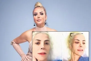Ameliyat paylaşımı