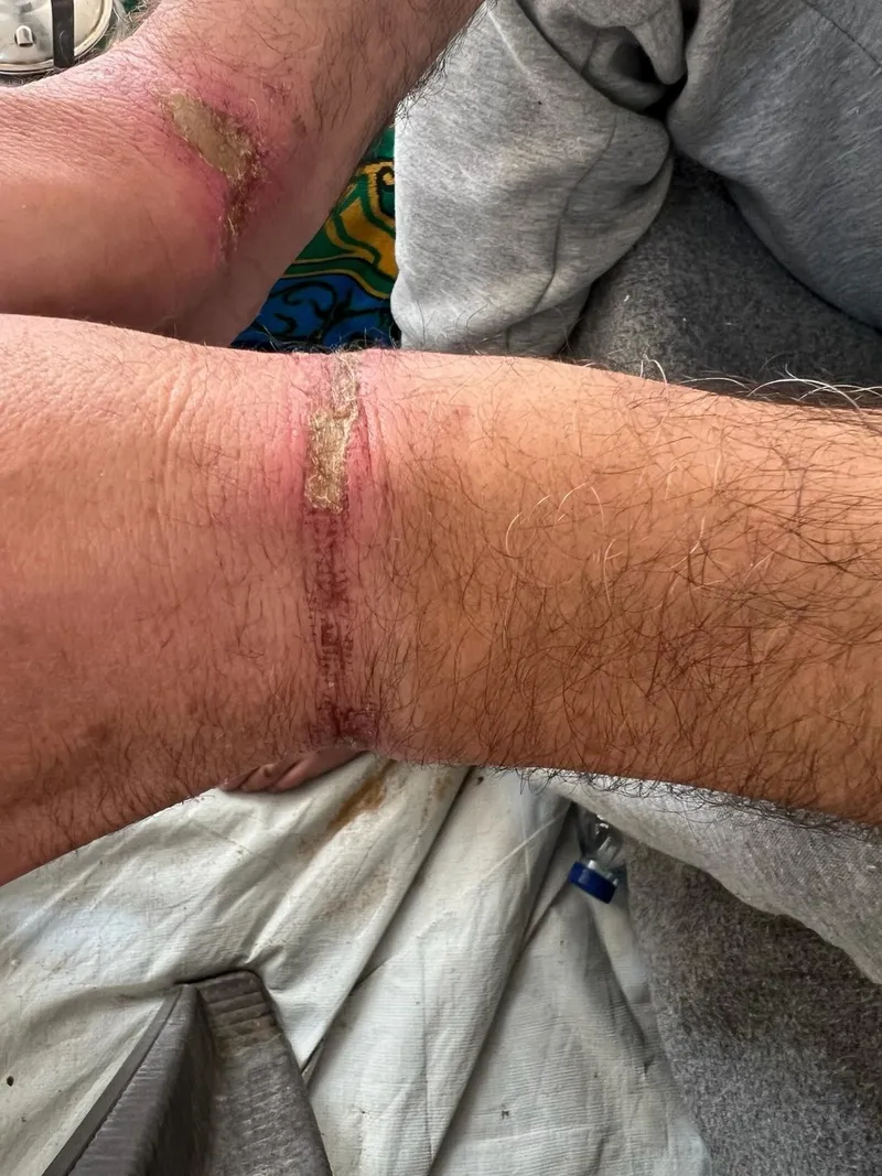 soykirimci-israil-vahsete-doymuyor-el-emel-hastanesinde-alikoydugu-2-doktora-uyguladigi-iskencenin-fotograflar-1708186240832.jpeg Soykırımcı İsrail vahşete doymuyor! El-Emel Hastanesinde alıkoyduğu 2 doktora uyguladığı işkencenin fotoğrafları ortaya çıktı-5