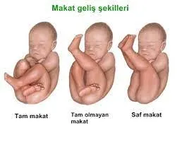 ters-dogum-nedir-dogum-kocu-evde-dogum-yaptirdi-ters-gelen-bebek-oksijensizlikten-oldu-1641993098076.jpg Ters doğum nedir? Doğum koçu evde doğum yaptırdı! Ters gelen bebek oksijensizlikten öldü-14